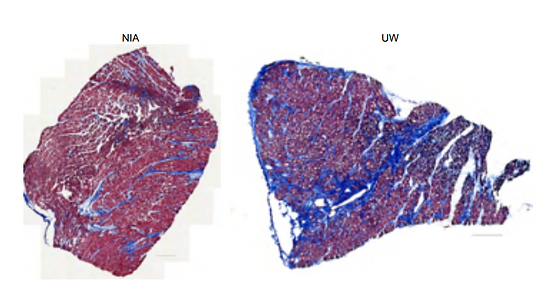 Effect of dietary fat and sucrose consumption on cardiac fibrosis in mice and rhesus monkeys