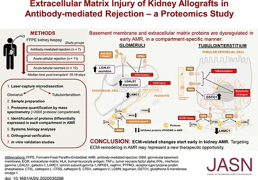 Extracellular Matrix Injury of Kidney Allografts in Antibody-Mediated Rejection- A Proteomics Study